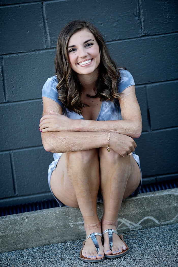 kilee 6
